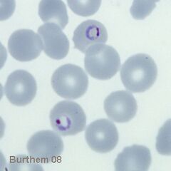 Typical accole forms lying on the edge of the infected erythrocyte