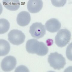 Plasmodium falciparum early trophozoite with typical small and delicate appearance in typical "ring" form