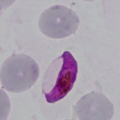 Macrogametocyte A nice typical form with scanty well-formed Maurers dots