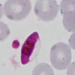 Macrogametocyte also Maurers dost and clefts, slight crenation and lost pallor