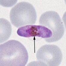 Gametocyte P.falciparum