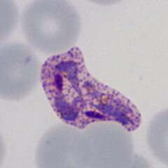 Intermediate ring Irregulat parasite, an enlarged distorted red cell and marked dots