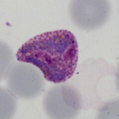 Very early double dot form Very early red cell changes with fine dots visible