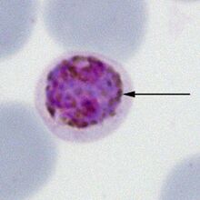 Gametocyte P.malariae