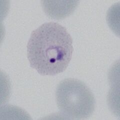 Very early double dot form Very early red cell changes with fine dots visible