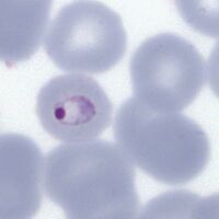 Ring form in small red cell