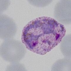 Classical amoeboid form note also the very enlarged distorted red cell