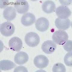 Multiple parasites in a single erythrocyte (one double chromatin dot form)