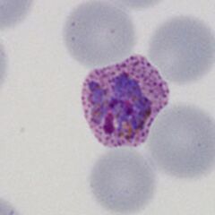 Early ring form Dots are more visible and the red cell begins to show distortion.
