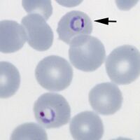 Double chromatin dot form