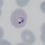 Early ring form
