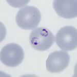 Multiple parasite form