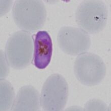 : P.falciparum microgametocyte