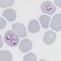 Late rings Two cells both with typical dots: multiply infected and double dot forms
