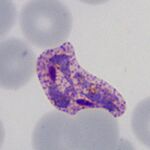 Intermediate/late trophozoite