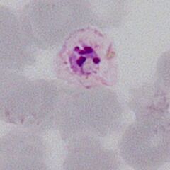 A single merozoite the parasite is recognisable with just 4-5 merozoites and no pigment within a degenerate erythrocyte