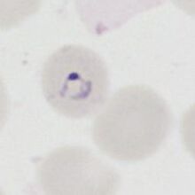 small or normal P.malariae (round)