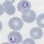 Double dot form and normal ring