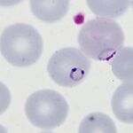 Accolé and double dot forms
