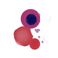 Population A debris, platelets, unlysed red cells