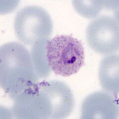 Early ring form Dots are now more visible and the red cell begins to show fimbriation.