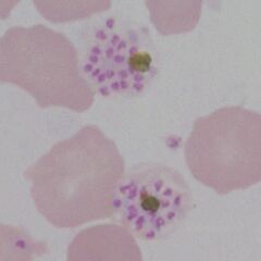 Late schizonts: 16-20 late merozoites prior to release are well formed and clearly separated with obvious pigment