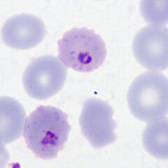 Small thick forms the red cell crenation is well demonstrated with scanty dots